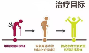 强直性脊柱炎怎么治疗