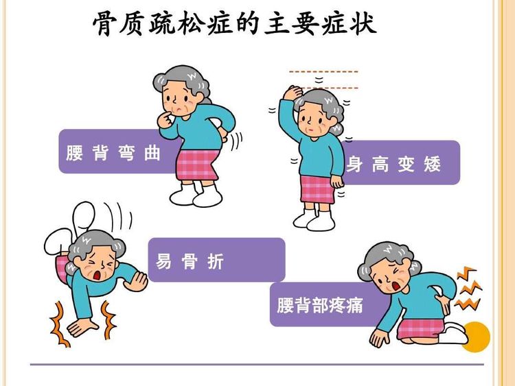 骨质疏松的症状表现、鉴别诊断、护理措施、怎么治疗