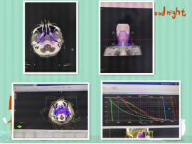 临床医师勾画放疗靶区并确定放疗剂量