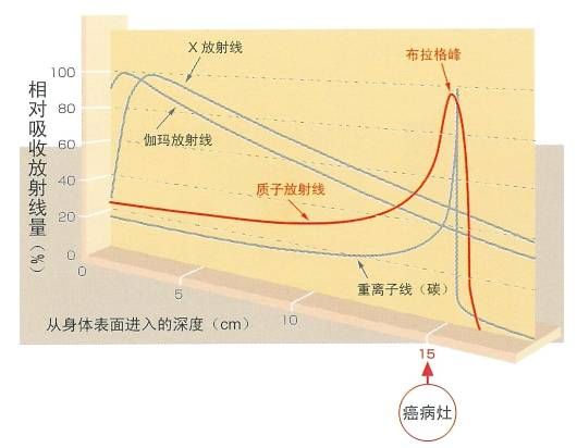 质子重离子治疗和放疗的区别