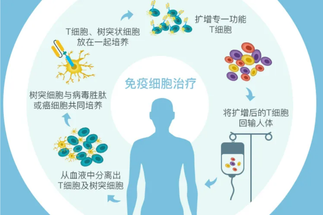 免疫细胞治疗