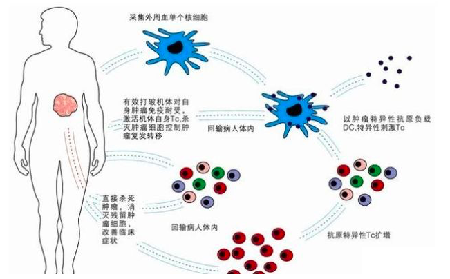 细胞疗法治疗过程