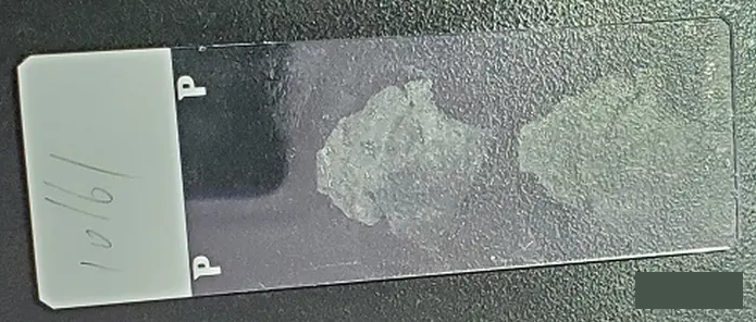 肿瘤组织白片取样