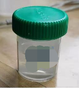 肿瘤基因检测怎么取样