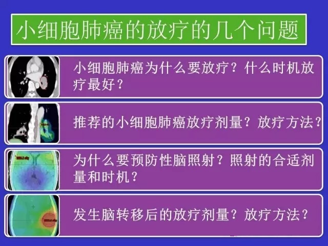 小细胞肺癌放疗效果好吗
