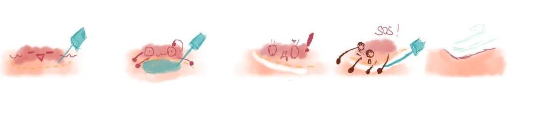 内镜下黏膜剥离术
