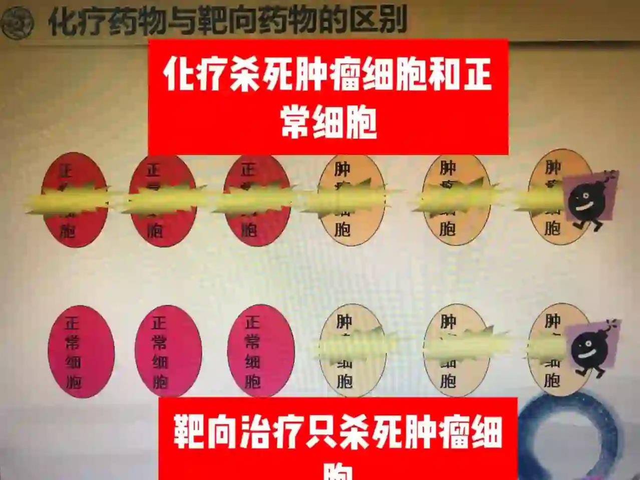 胃癌靶向药与化疗比较:选择更合适的治疗方案